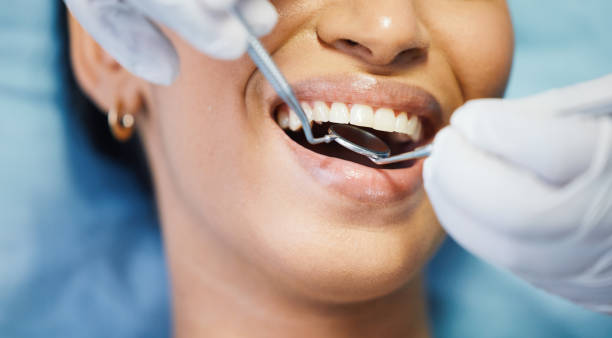 Best Emergency Dental Care for Sports Injuries in High Bridge, WA